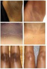 2 X Dark Skin Bleaching Cream Whitening Lightening Aha - Face   Body  - 15g