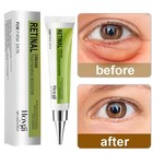 Retinol Firming Eye Cream - Remove Wrinkle Eye Bags Dark Circles Anti Puffiness