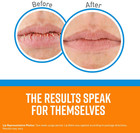 Cooling Relief Lip Repair Lip Balm For Dry  Cracked Lips  Stick   pack Of 2 
