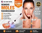 Anti-aging Laser Plasma Pen Mole Removal Dark Spot Skin Tag Tattoo Wart Remover