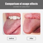 Tongue Scraper Cleaner Stainless Steel Dental Fresh Breath Cleaning Oral Care