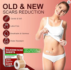 Silicone Scar Sheets  1 6   x 60    Roll-1 5m   Medical Grade Silicone Scar Tape Rol