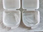 Custom Clear 2 Retainers For Teeth -upper And Lower  free 3-way Shipping 