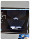 Nomos Sonalis Ultrasound Imaging System W  Probe