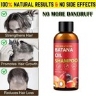 Best Fastest Hair Loss Regrowth Thinning Shampoo 100ml