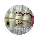 Tmj Temporomandibular Jaw Gpi Model  Lfa  2880  Make Us An Offer  See Video