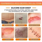 Silicone Scar Sheets  1 6 x60  Roll-1 5m   Medical Tape Beige 