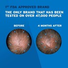 Kirkland Hair Regrowth Treatment 5  Minoxidil Foam For Men - 6 Month Supply