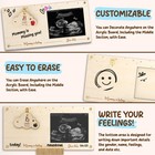 Pregnancy Milestone Countdown Board With Ultrasound Sonogram Picture Frame        