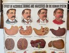 Hardacre Temperance Map Chart Effects Of Alcohol Tobacco On Human Body System