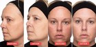 Kojic Acid Skin Whitening Lightening Brightening Serum Bleaching spot Fade Cream