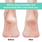 Vaincre Gel Moisturizing Heel Socks For Dry Cracked Feet Regular  Multi-color