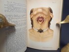 125 Yr Old Surgery Book 270 Figs   40 Plates  Images Antique Medical   0 Tariffs