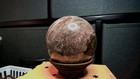 Natural Unakite Crystal Sphere 586g Polished Stone Ball Green Pink Quartz