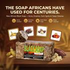 Raw African Black Soap - Acne  Eczema  Dark Spots   Deep Cleanse Eczema Relief