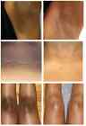 Dark Skin Bleaching Cream Whitening Lightening Aha - Face   Body  - 15g