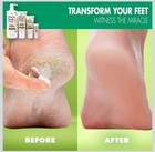 Miracle Foot Repair Cream For Dry Cracked Feet 8 Oz Each  pack Of 2 
