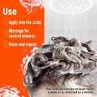 Medicasp Coal Tar Gel Dandruff Shampoo To Treat Seborrheic Dermatitis Psoriasis