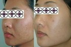 10-20-30-40-50-60-70  Glycolic Acid Night Cream 2oz  60ml  Aging acne scar
