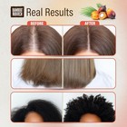 Raw Batana Oil For Hair Growth Organic 100  Pure  4 Oz  For Thick And Strong Nat