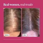Viviscal Pro Professional Hair Growth Supplement 180 Tablets For Men And Woman