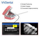 Dental Sensors Tooth Root Exposure Receptor  Data Cable High Definition Lmage