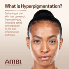 Ambi Skin Dark Spot Fade Cream Lightening Bleaching Cream Dark Spot Whitening