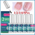 Rozino 3 Days Nail Care Keratin Amino Acid Formula Nail Strengthener Nourishing