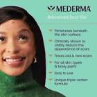 Mederma Advanced Scar Gel 50g Cream Treatment Skin Care Old   New Scars
