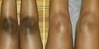 Dark Skin Bleaching Cream Whitening Lightening Aha - Face   Body  -  15g 