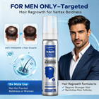 Men s 5  Topical Minoxidil Aerosol Foam Unscented  Biotin Infused Hair Beard Gro