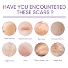 Scar Repair Cream Stretch Mark Skin Repair Postpartum Moisturizing Cream