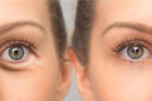 Hyaluronic Acid   Vitamin C Eye Lift Serum Remove Crows Feet Bags Firm Antiaging