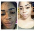 2 skin Lightening Cream Extra Strength Lighter Fast Result-no Side Effects