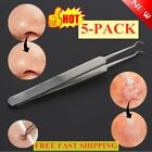 Blackhead Facial Acne Spot Pimple Remover Tweezer Curve Extractor Tool Comedone