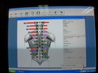 Myovision 8000 Static Semg With Validated Laptop Chiropractic Chiropractor