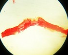 Antique Microscope Slide  Human Skin  Read Label For Details 