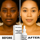 Derma Snow Whitening Face   Body Cream     Skin Lightening     Aclarador De Piel