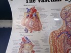 Vascular System Medical Chart  26x20 Laminated  By Anatomical Chart Co 