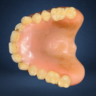 Vintage Upper Dentures With Gold Fillings     Unusual Dental Collectible