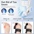 Bunion Fix Toe Valgus Corrector Big Toe Straightener Adjustable For Men   Women