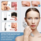 60pcs Dual Blackhead Remover - Pimple   Comedone Extractor Removal Tool Kit