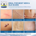 Scar Removal Cream - Rapid Repair Of New   Old Scars  Acne Spots  Burns