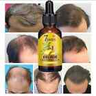 7 Day Fast Hair Growth Oil Ginger Growth Hair Treatment Anti Hair Loss Men Women