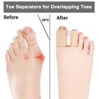 Bunion Corrector Toe Splint Straightener Hallux Valgus Foot Separator 4-12 Pcs 