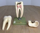 Vtg Sosmo Tooth Anatomical Model Display Dental Dentistry Eductational Germany