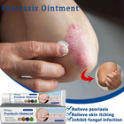 3x Psoriasis Dermatitis Eczema Natural Cream Skin Treatment Ointment Free Ship