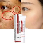 Effective Whitening Freckle Cream Remove Dark Spot Cream Removal Melanin Melasma