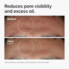 The Ordinary Niacinamide 10    Zinc 1   Smoothing Serum For Blemish-prone Skin