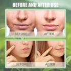 4pcs Green Tea Pack Stick Facial Cleansing Oil Acne Blackhead Control Deep Clean